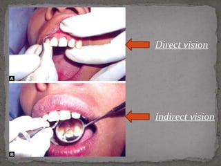 Principles of periodontal instrumentation [autosaved] | PPTX