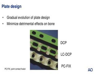 Fic Plate principles of plating in fracture management.pptx