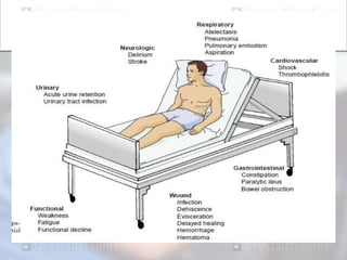 Principles of pt in post operative cases (general | PPTX
