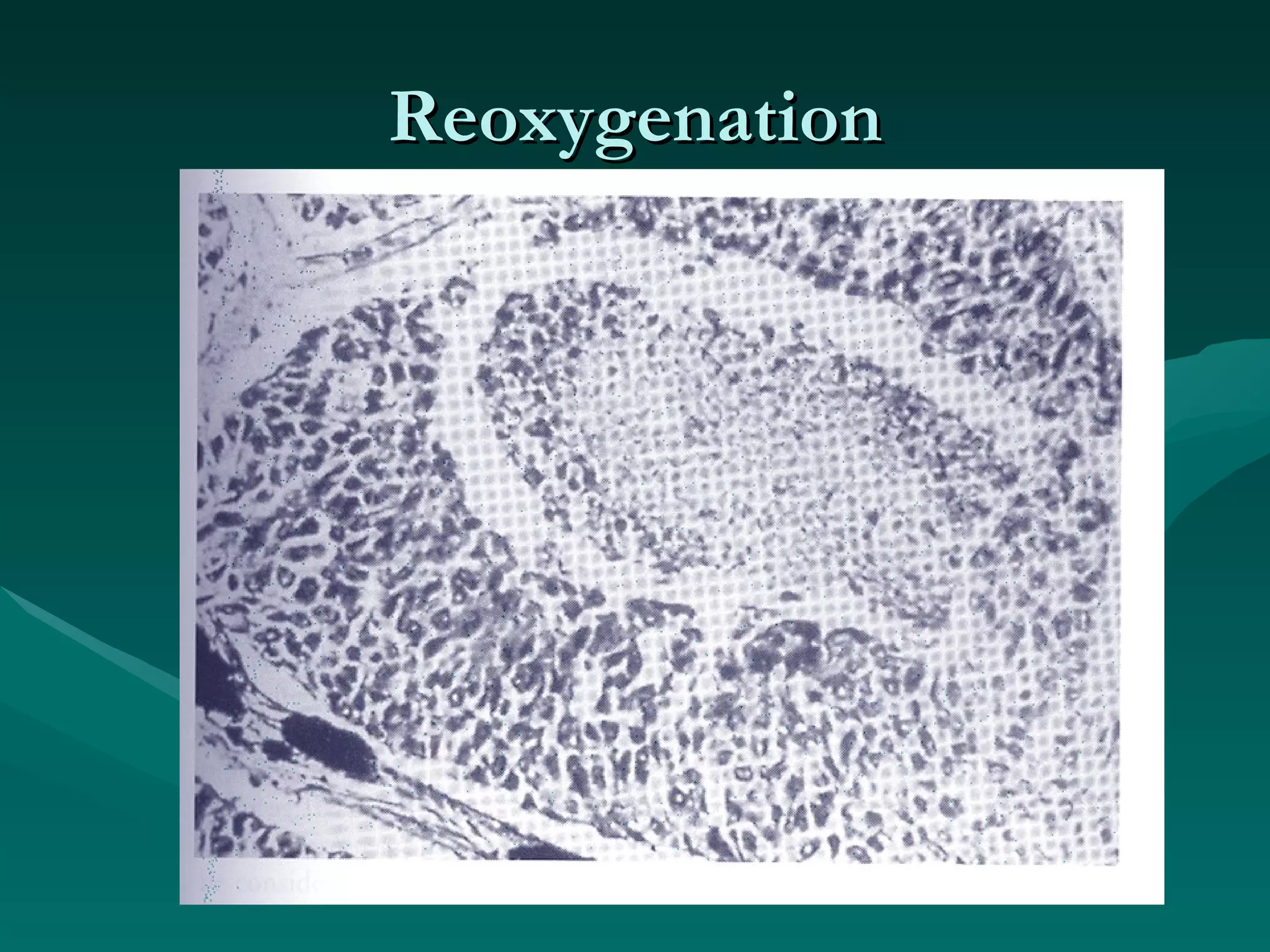 Reoxygenation 
