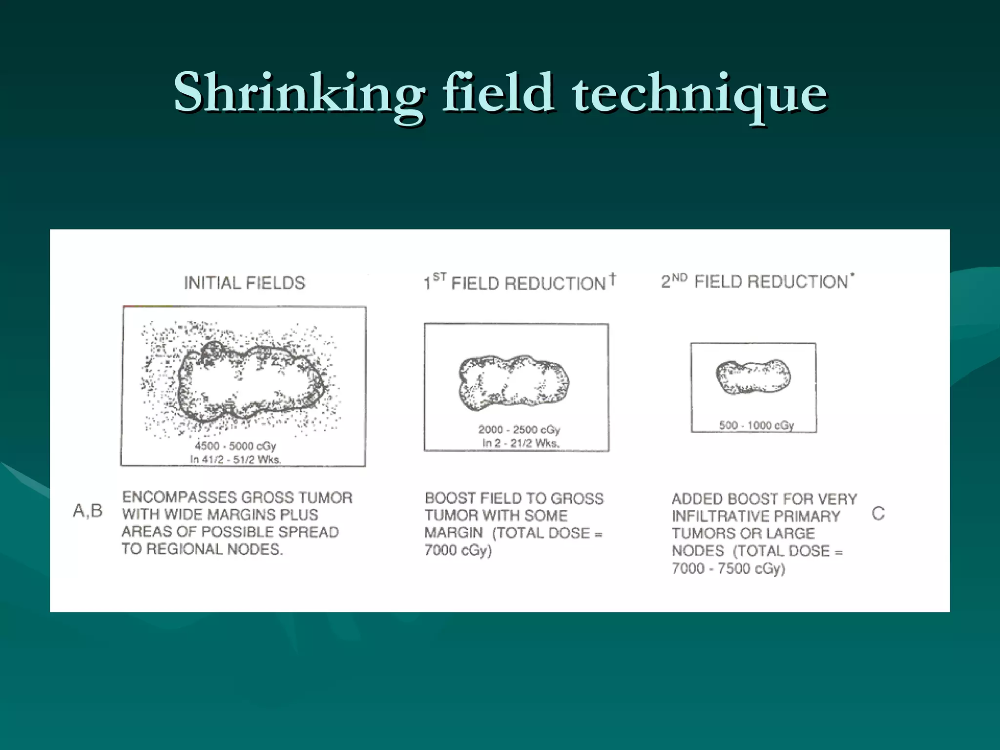 Shrinking field technique 