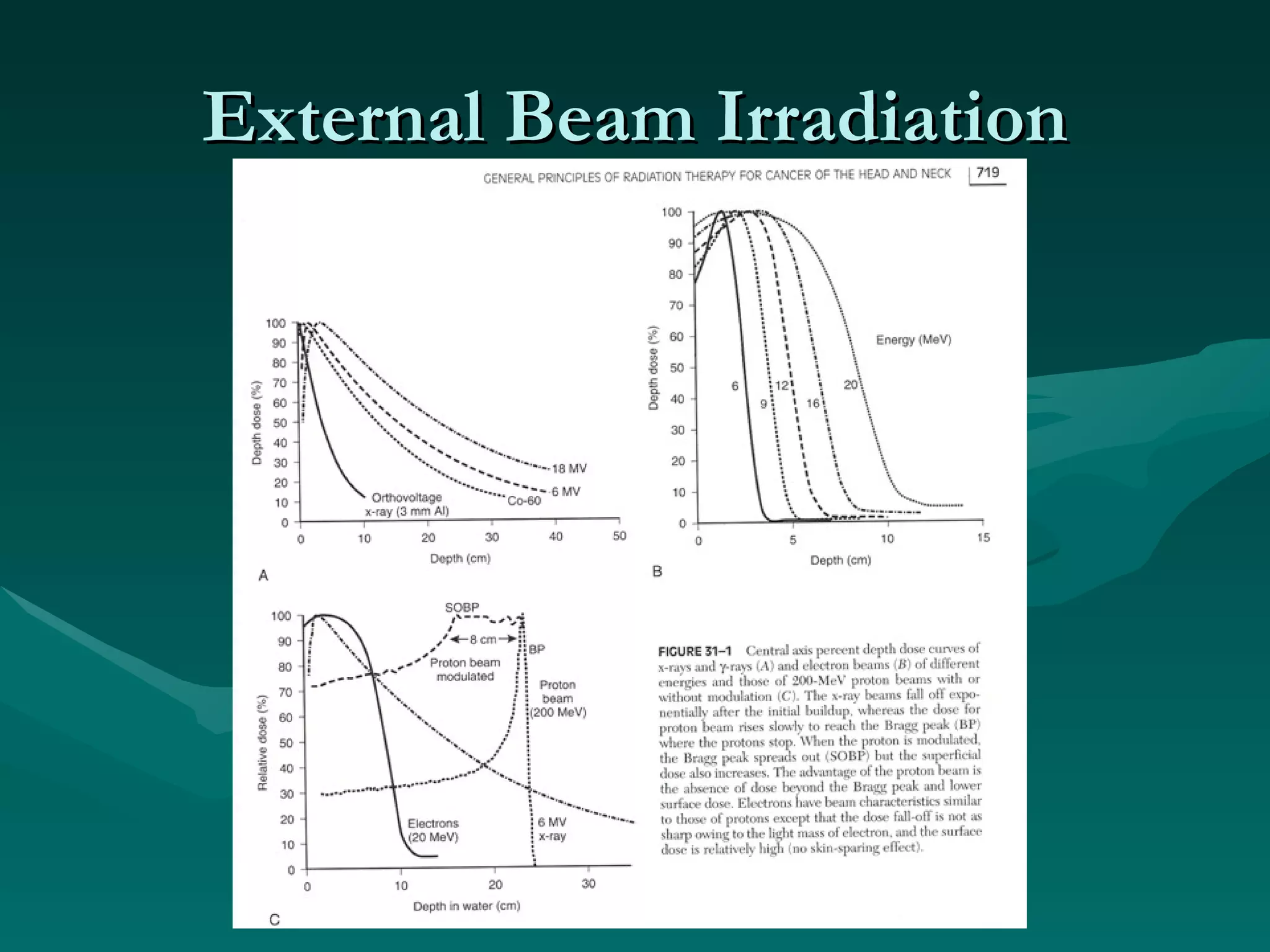External Beam Irradiation 