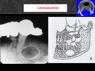 Goo Radiographic Features Examples Principles of radiographic interpretation | PPTX
