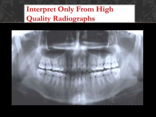 Goo Radiographic Features Examples Principles of radiographic interpretation | PPTX