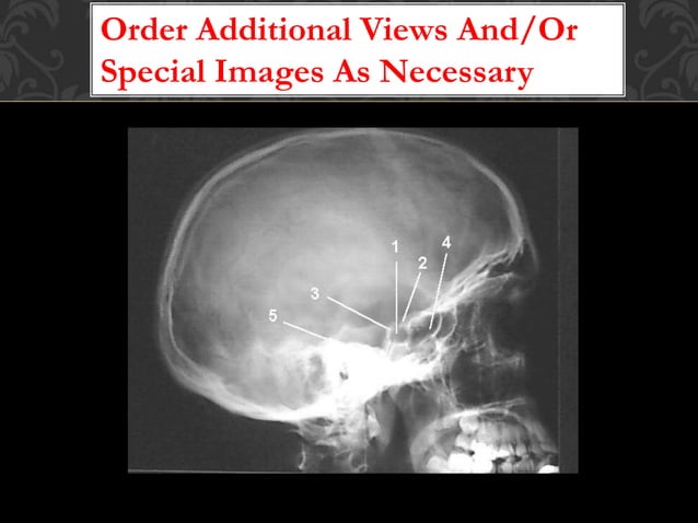Principles of radiographic interpretation | PPTX | Bone and Joint ...