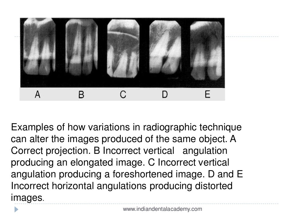Principles of radiographic interpretation/ dental courses