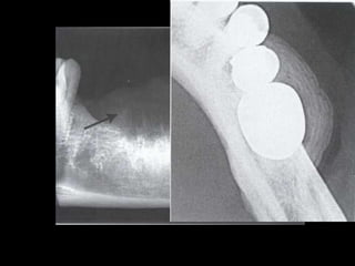 Undercut Radiograph Principles of radiographic interpretations | PPTX