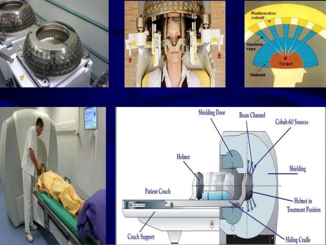 Radiation In Medical Radiotherapy: basic concepts and recent advances _ what is radiation ...