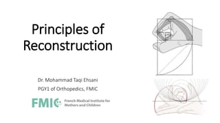 Principles of
Reconstruction
Dr. Mohammad Taqi Ehsani
PGY1 of Orthopedics, FMIC
 