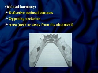 Occlusal Support Rpd Principles of RPD by Dr. Anand Rajapur | PPT
