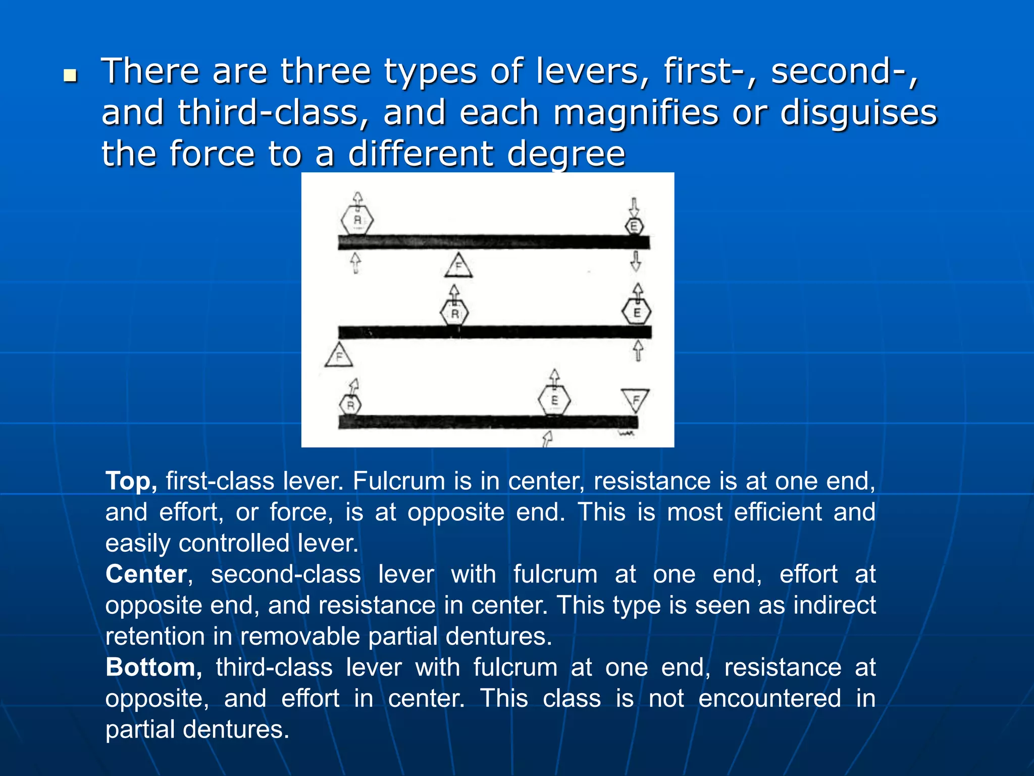 Principles of rpd design | PPT