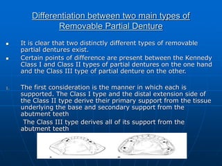 Principles of rpd design | PPT