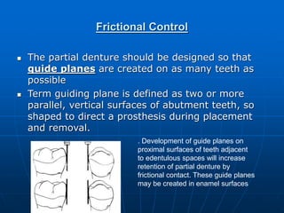 Principles of rpd design | PPT