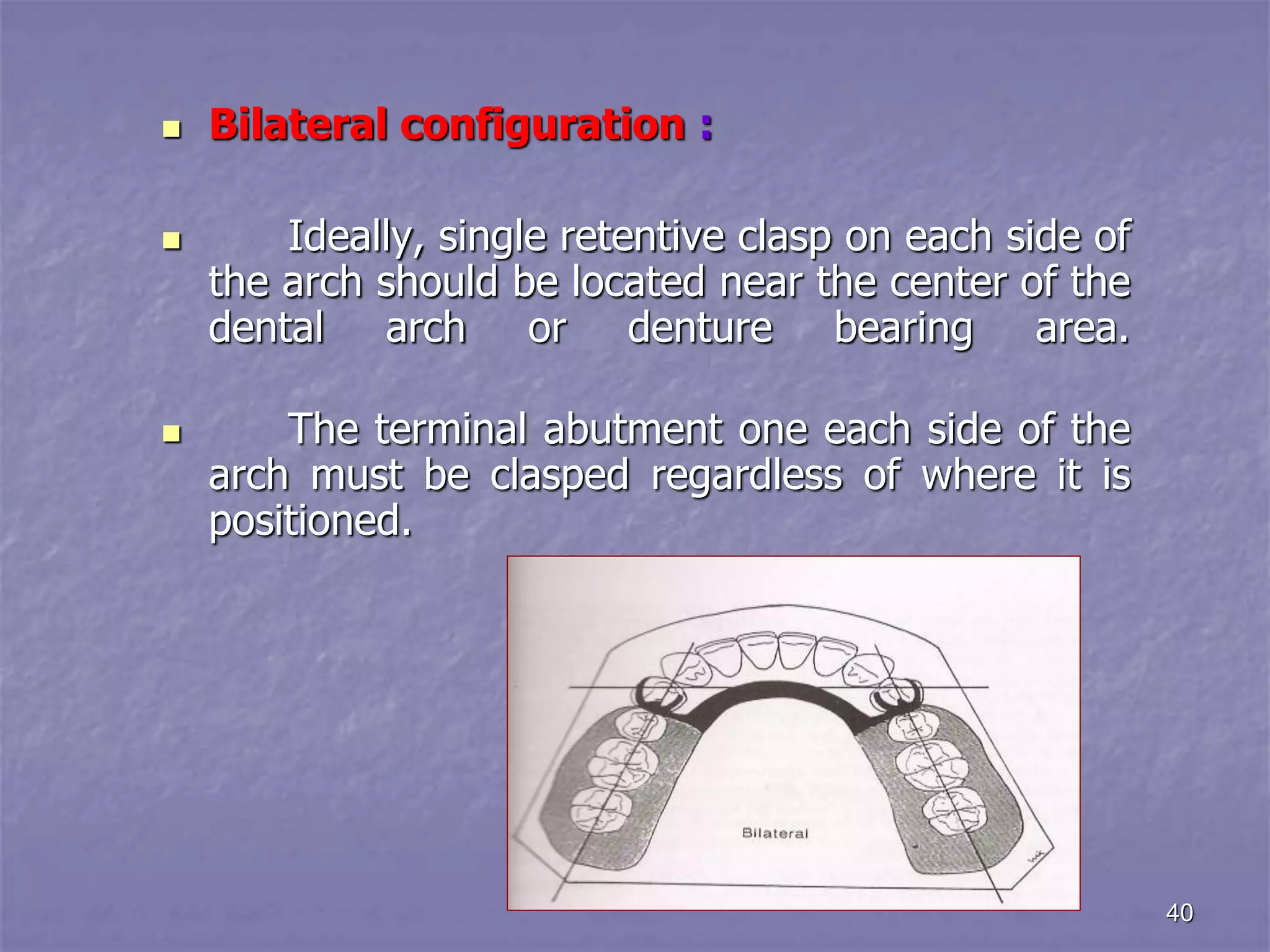 principles of rpd design.ppt