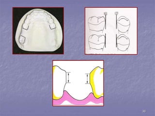 principles of rpd design.ppt