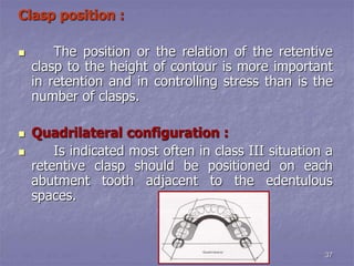 principles of rpd design.ppt