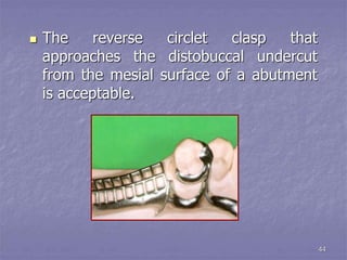 principles of rpd design.ppt