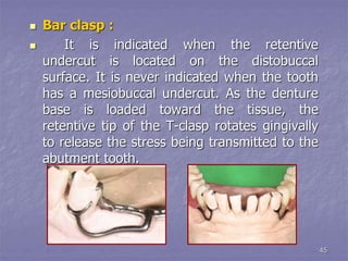 G Clasp Rpd principles of rpd design.ppt