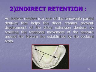 principles of rpd design.ppt