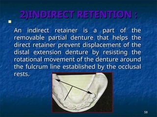Rotational Rpd Retainer principles off removable partial denture | PPT