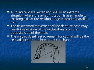 Unilaterla Rpds principles off removable partial denture | PPT