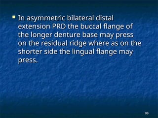principles off removable partial denture | PPT