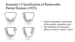 Kennedy Classes Rpd Principles of RPD designing | PPTX