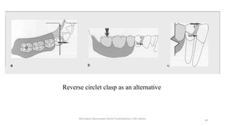 Principles of RPD designing | PPTX