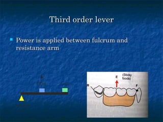 Lever System Rpd principles of rpd designing.ppt design consideration | PPT