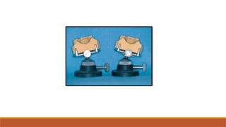 Comprehensive Principles and Design of Removable Partial Dentures (RPD ...