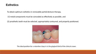 Comprehensive Principles and Design of Removable Partial Dentures (RPD ...
