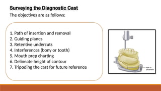 Surveying Study Cast Rpd Comprehensive Principles and Design of Removable Partial Dentures (RPD ...