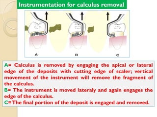 Principles of scaling & root planing dr alaa attia | PDF