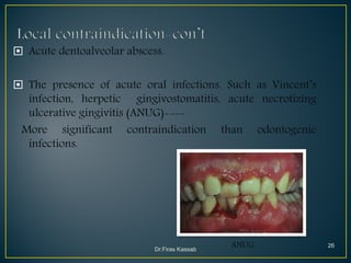 Principles of simple extractions 1 | PDF
