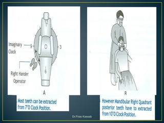 Principles of simple extractions 1 | PDF