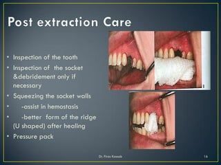 Principles of simple extractions 3 | PDF