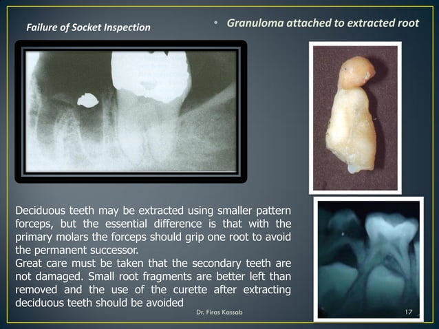 Principles of simple extractions 3 | PPT