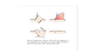PRINCIPLES OF SKIN INCISION PRINCIPLES OF SKIN INCISION | PPTX