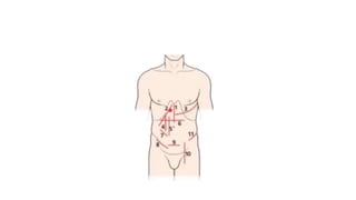 Skin Paddle Incision PRINCIPLES OF SKIN INCISION PRINCIPLES OF SKIN INCISION | PPTX