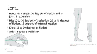Principles of splints and casts (2).pptx