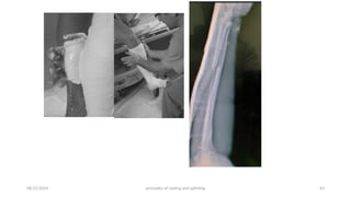 Principles of splints and casts (2).pptx