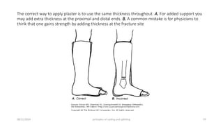 Principles of splints and casts (2).pptx