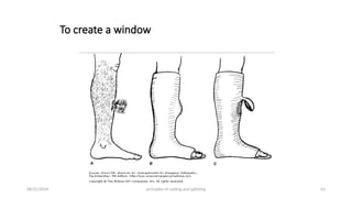 Principles of splints and casts (2).pptx
