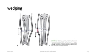 Principles of splints and casts (2).pptx
