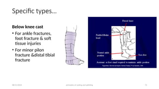 Principles of splints and casts (2).pptx