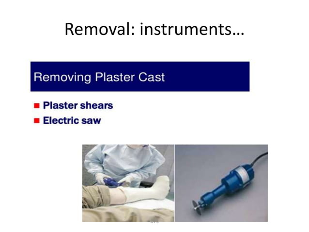 Principles of splints and casts in orthopaedics by Dr. D. P. Swami | PPTX