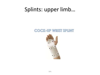 Splints Displayu Principles of splints and casts in orthopaedics by Dr. D. P. Swami | PPTX