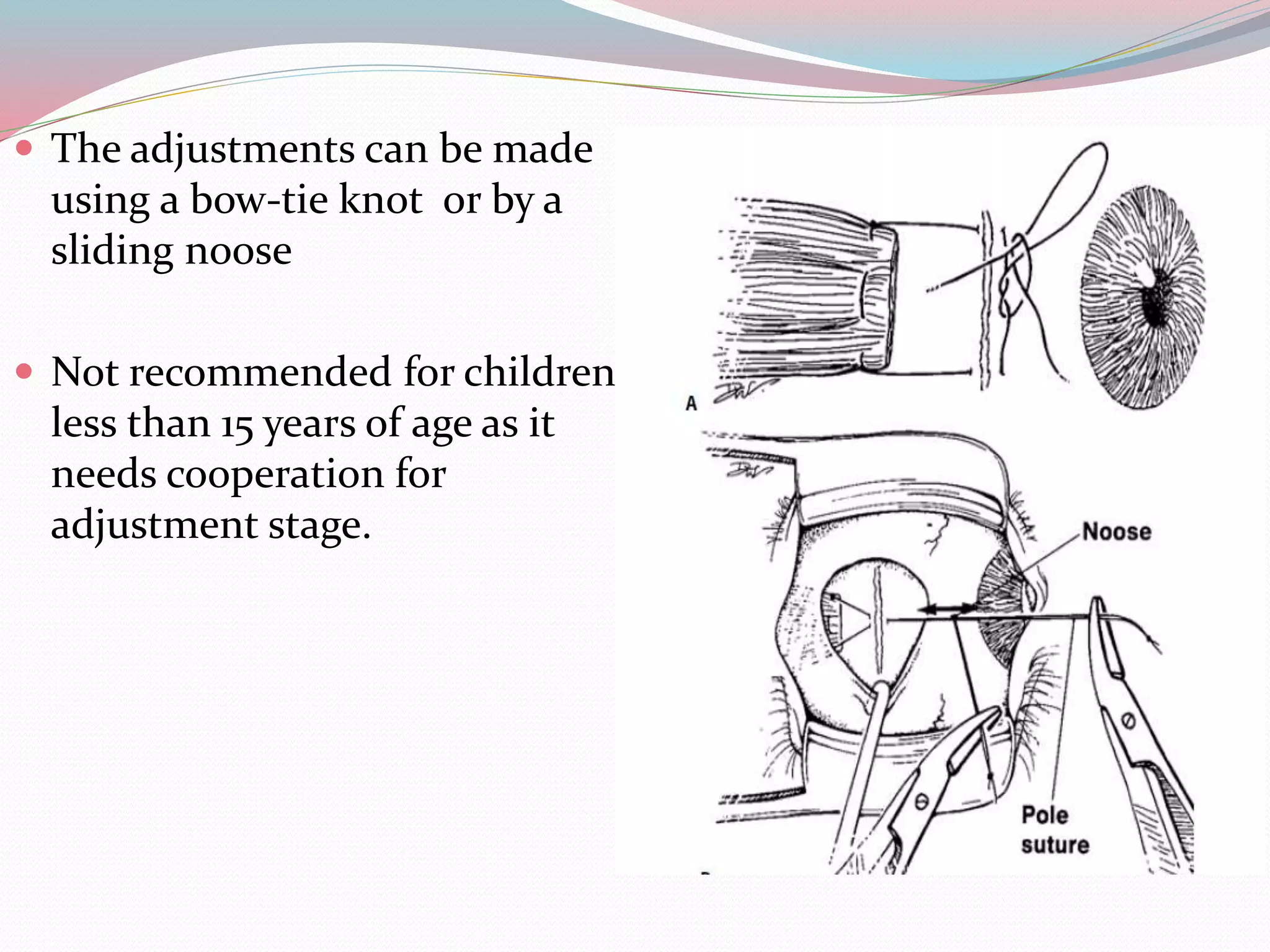  The adjustments can be made
using a bow-tie knot or by a
sliding noose
 Not recommended for children
less than 15 years of age as it
needs cooperation for
adjustment stage.
 