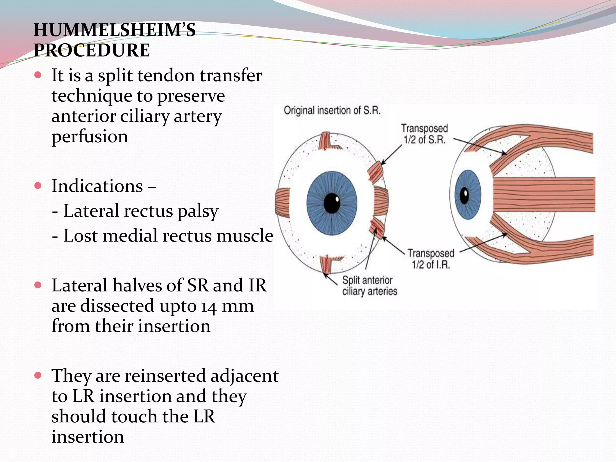 HUMMELSHEIM’S
PROCEDURE
 It is a split tendon transfer
technique to preserve
anterior ciliary artery
perfusion
 Indications –
- Lateral rectus palsy
- Lost medial rectus muscle
 Lateral halves of SR and IR
are dissected upto 14 mm
from their insertion
 They are reinserted adjacent
to LR insertion and they
should touch the LR
insertion
 