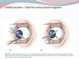 Principles of strabismus surgery | PPTX